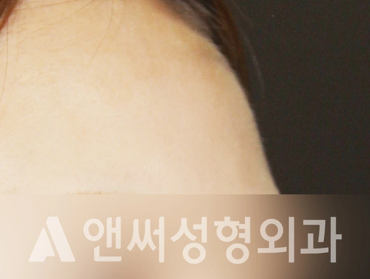 Answer Plastic Surgery case 367: Before