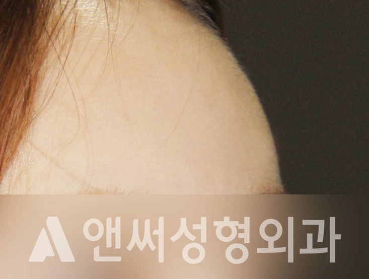Answer Plastic Surgery case 367: After