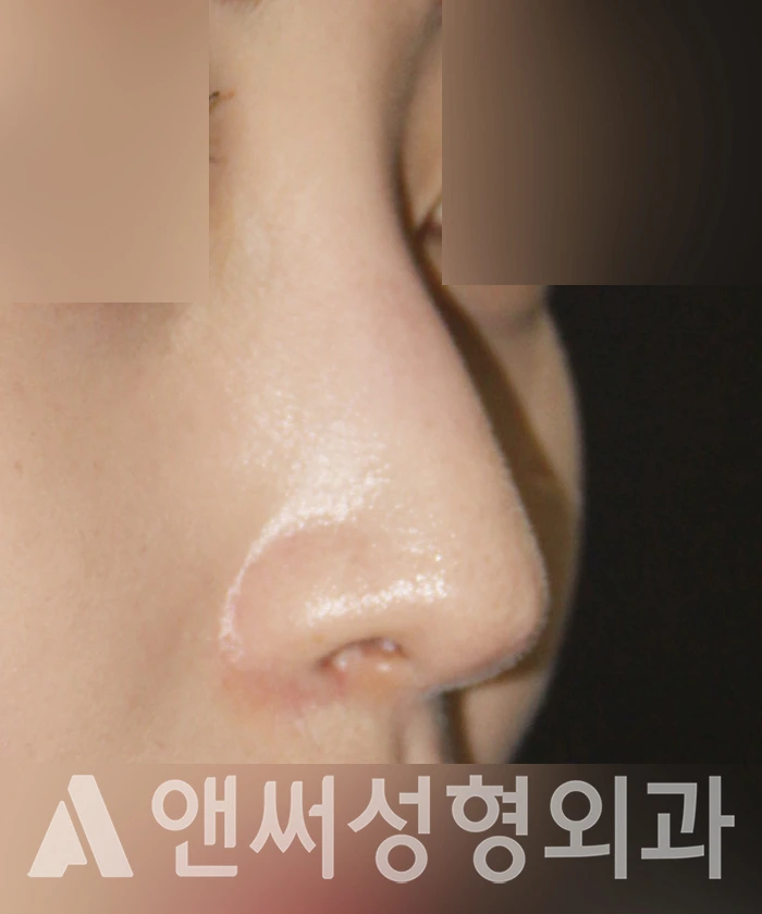 Answer Plastic Surgery case 362: Before