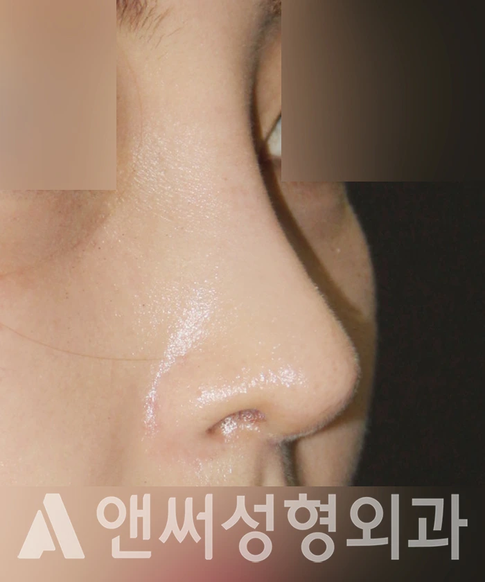 Answer Plastic Surgery case 362: After