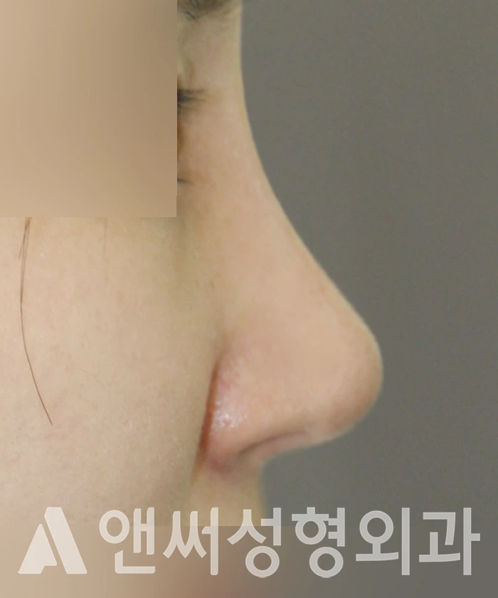 Answer Plastic Surgery case 361: After