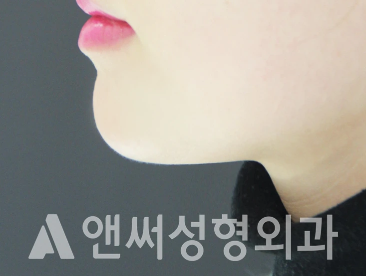 Answer Plastic Surgery case 360: After