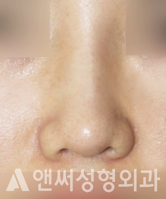 Answer Plastic Surgery case 319: After