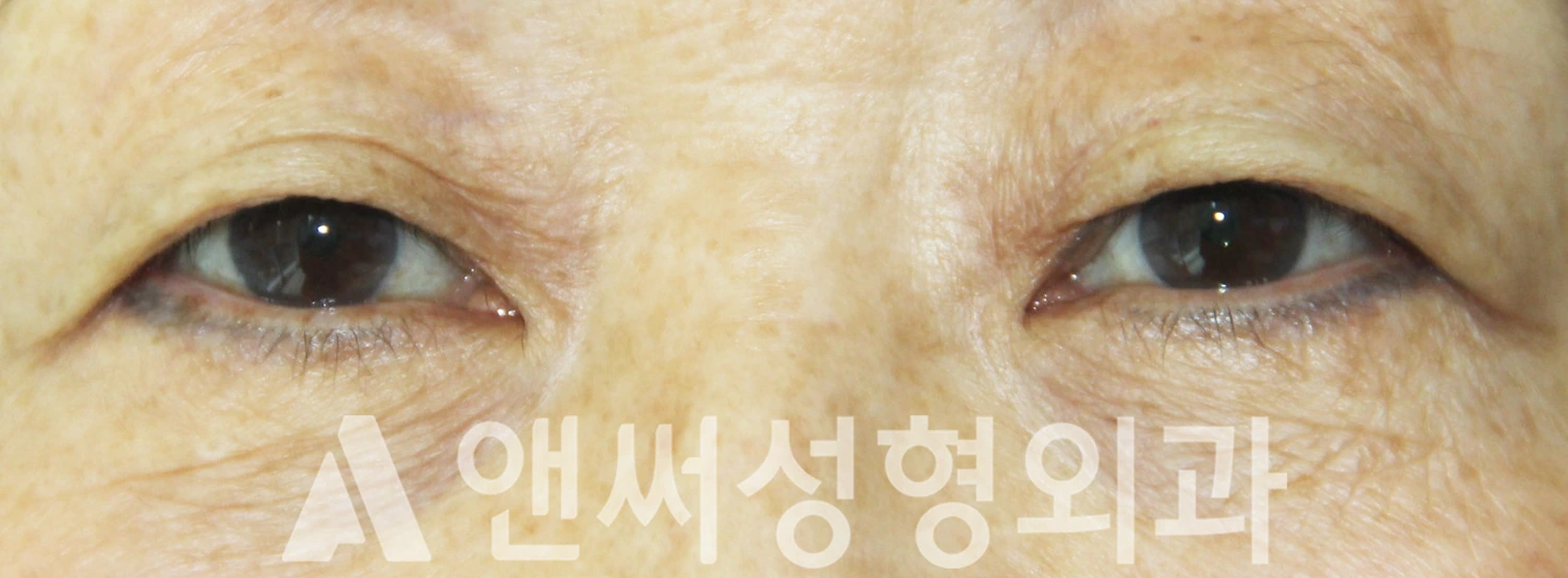 Answer Plastic Surgery case 359: Before