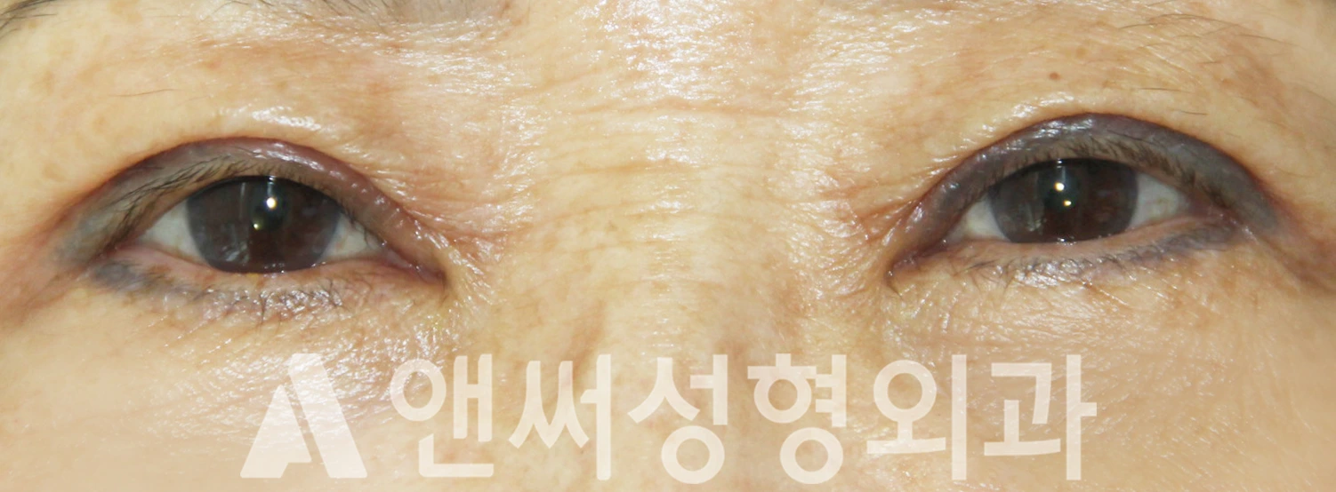 Answer Plastic Surgery case 359: After