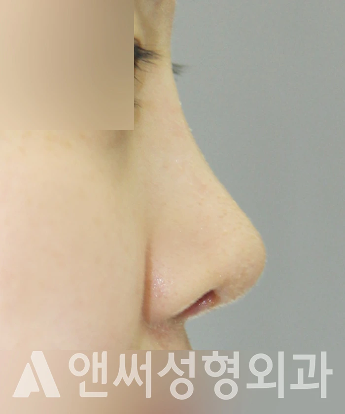 Answer Plastic Surgery case 358: After