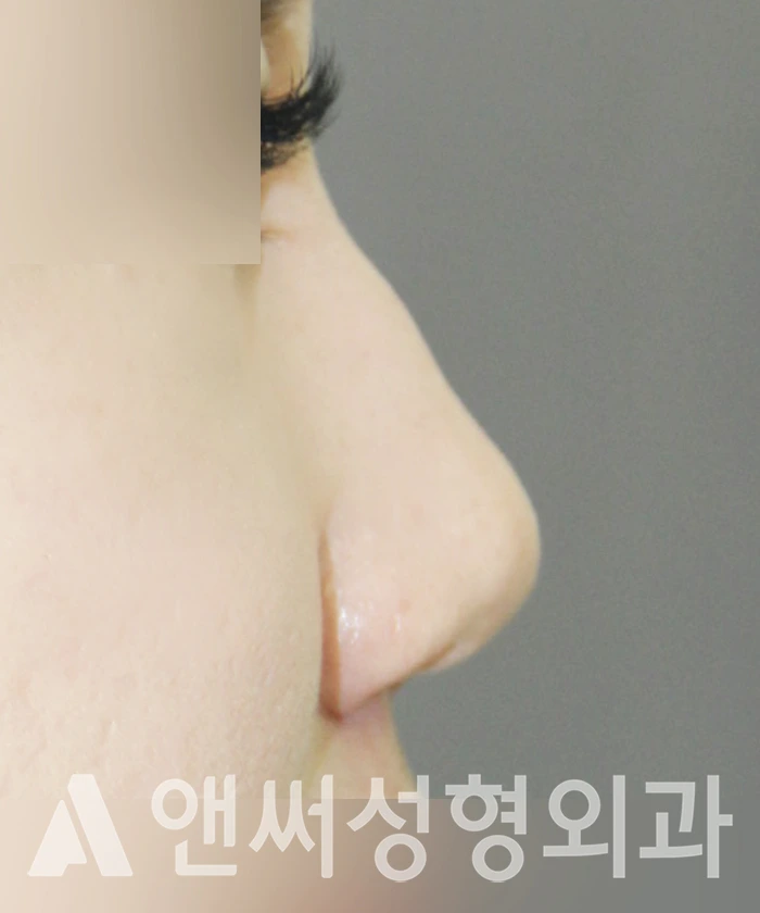 Answer Plastic Surgery case 357: Before