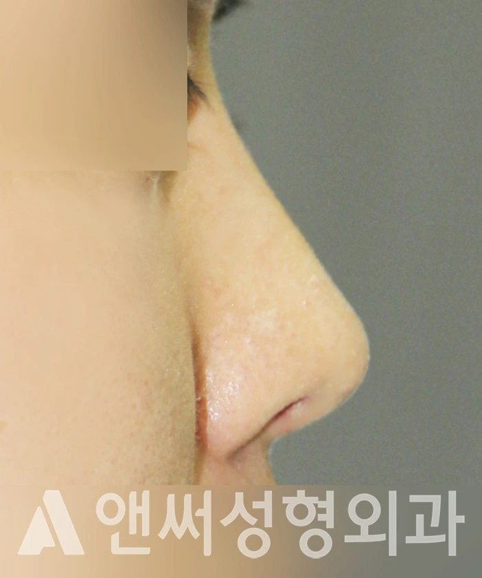 Answer Plastic Surgery case 356: After
