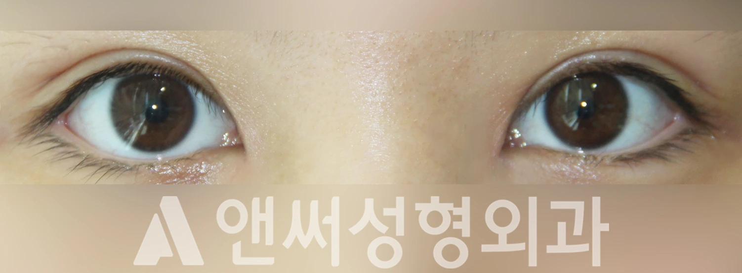 Answer Plastic Surgery case 355: After