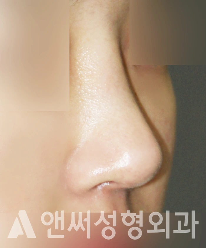 Answer Plastic Surgery case 354: After