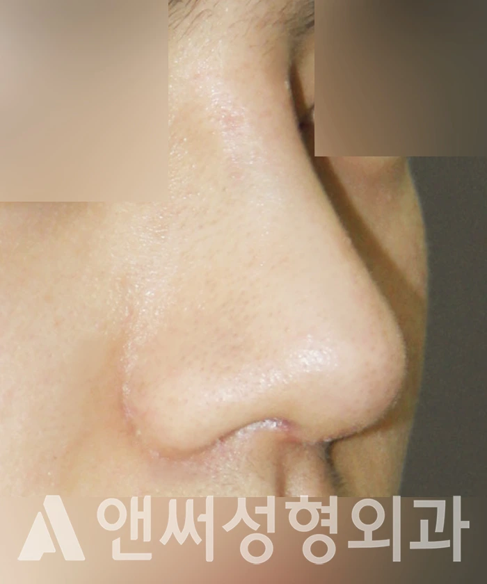 Answer Plastic Surgery case 353: After