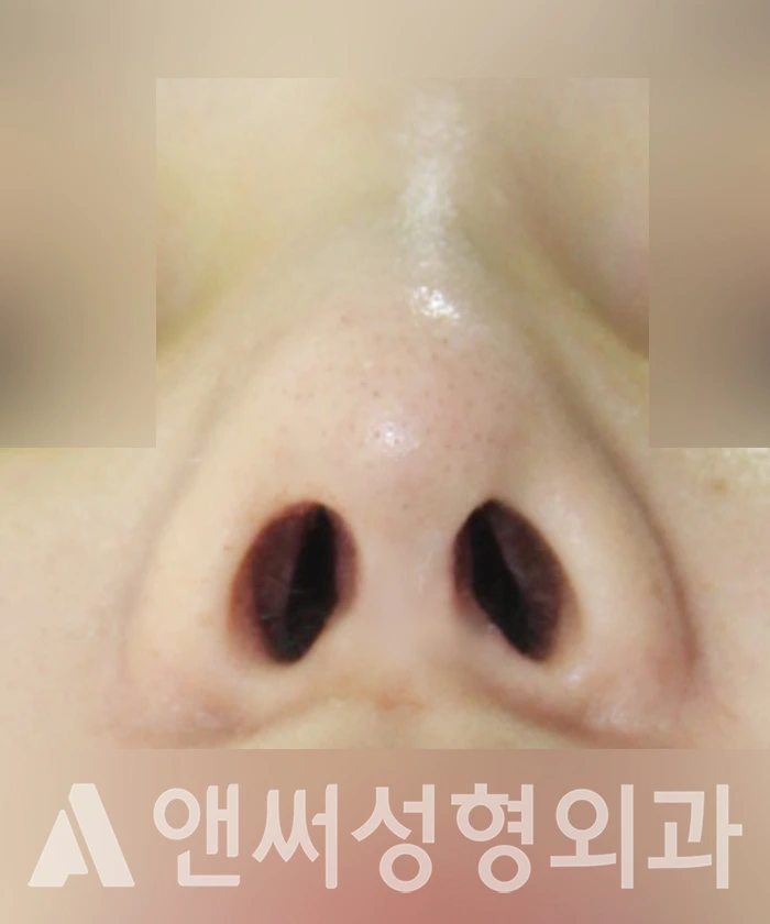 Answer Plastic Surgery case 352: After