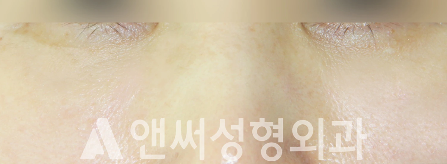Answer Plastic Surgery case 351: After