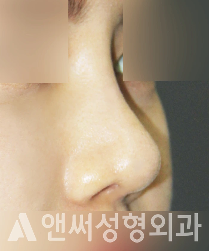 Answer Plastic Surgery case 350: After