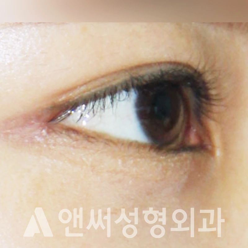 Answer Plastic Surgery case 349: After