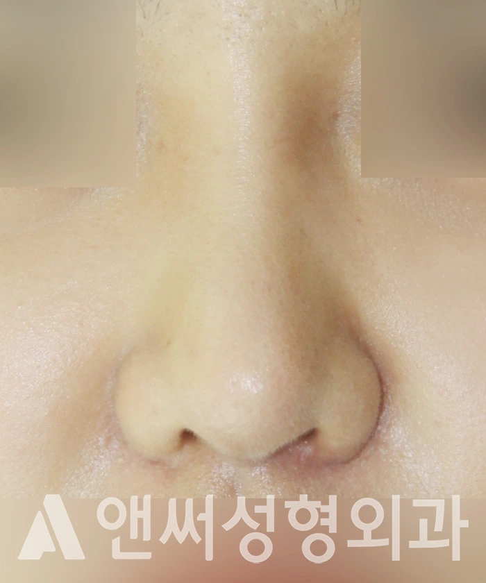 Answer Plastic Surgery case 347: After