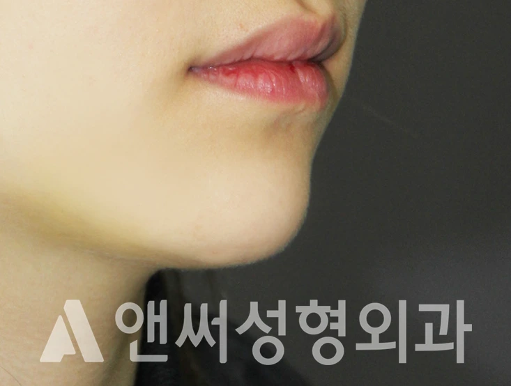 Answer Plastic Surgery case 341: After