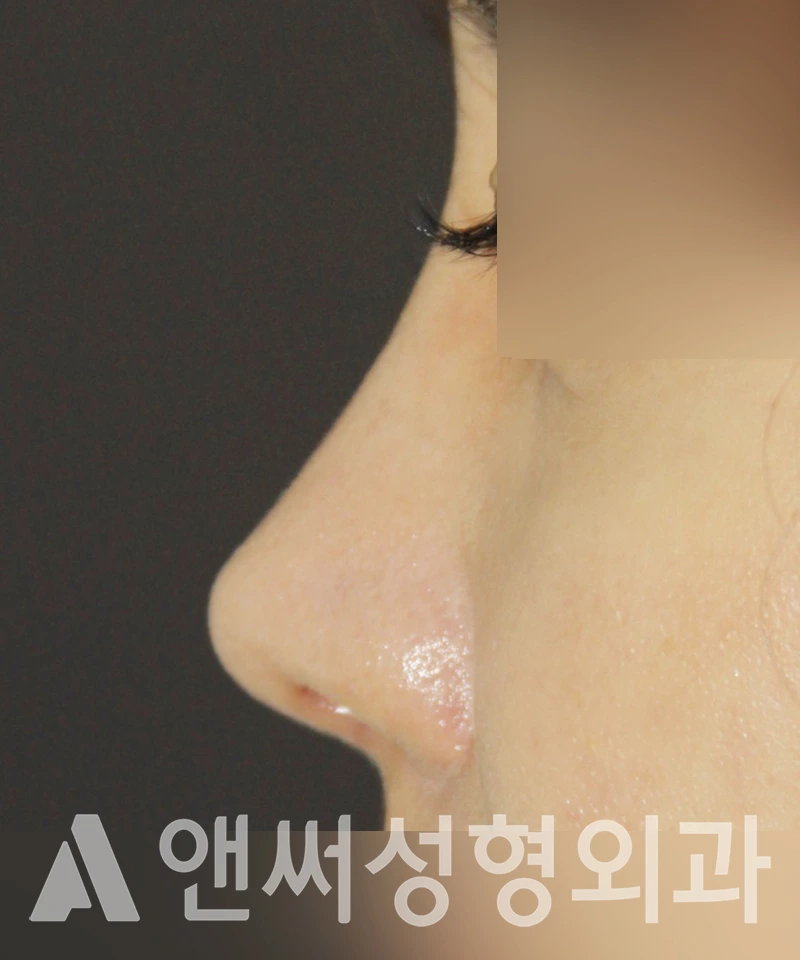 Answer Plastic Surgery case 340: After