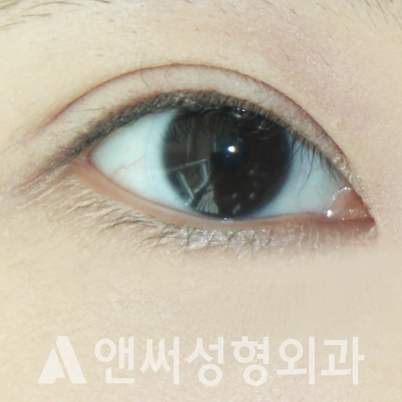 Answer Plastic Surgery case 339: After