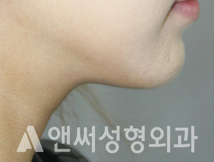 Answer Plastic Surgery case 338: After