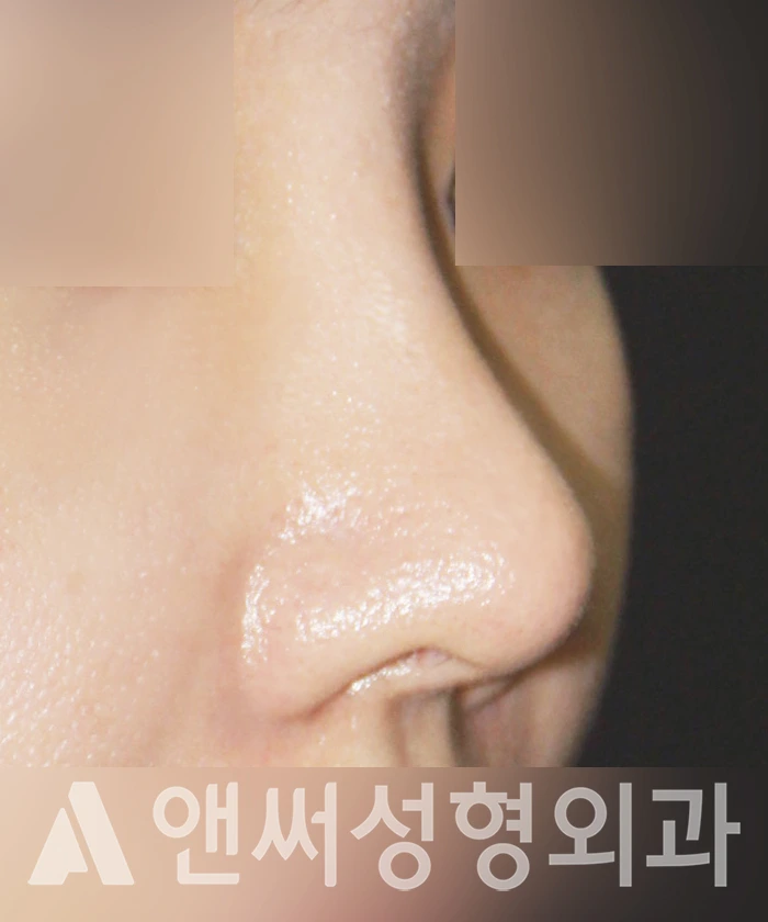 Answer Plastic Surgery case 336: After
