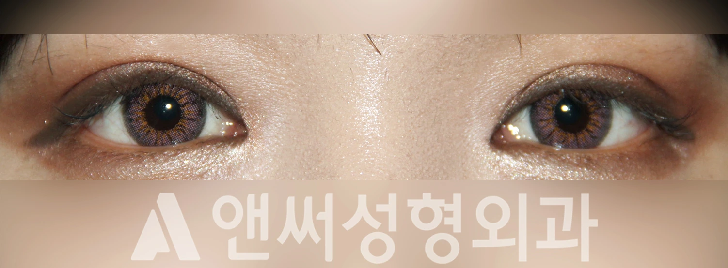 Answer Plastic Surgery case 335: After
