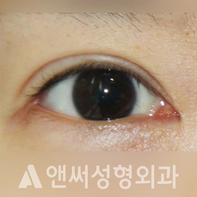 Answer Plastic Surgery case 334: After