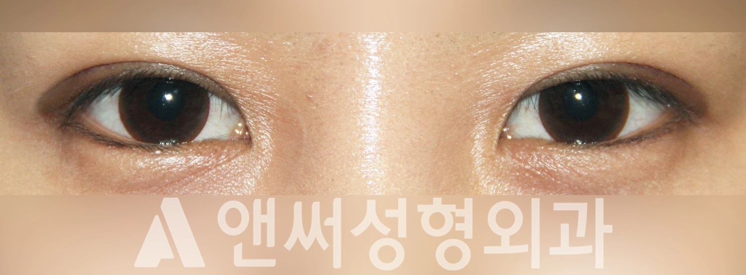 Answer Plastic Surgery case 332: After