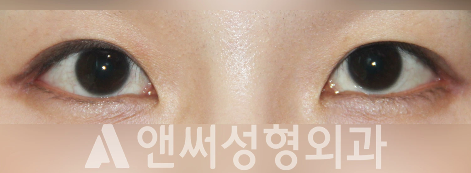 Answer Plastic Surgery case 331: After
