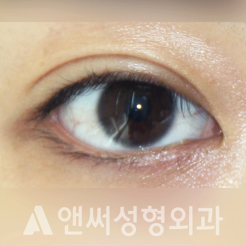 Answer Plastic Surgery case 330: After
