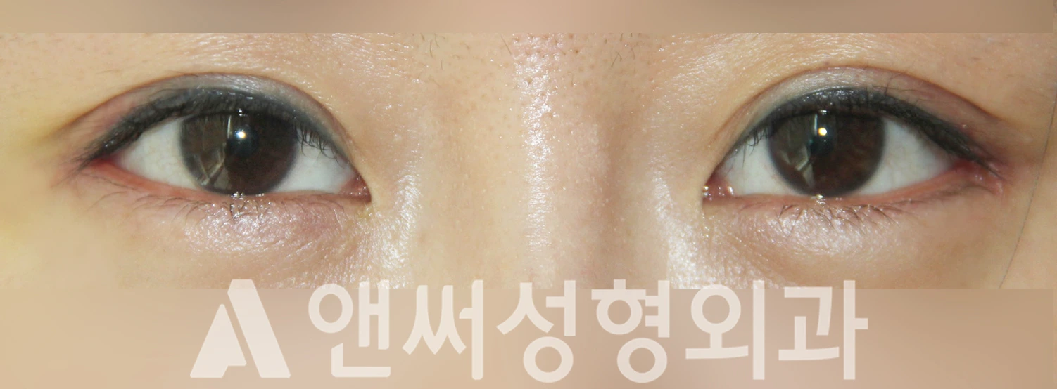 Answer Plastic Surgery case 329: After