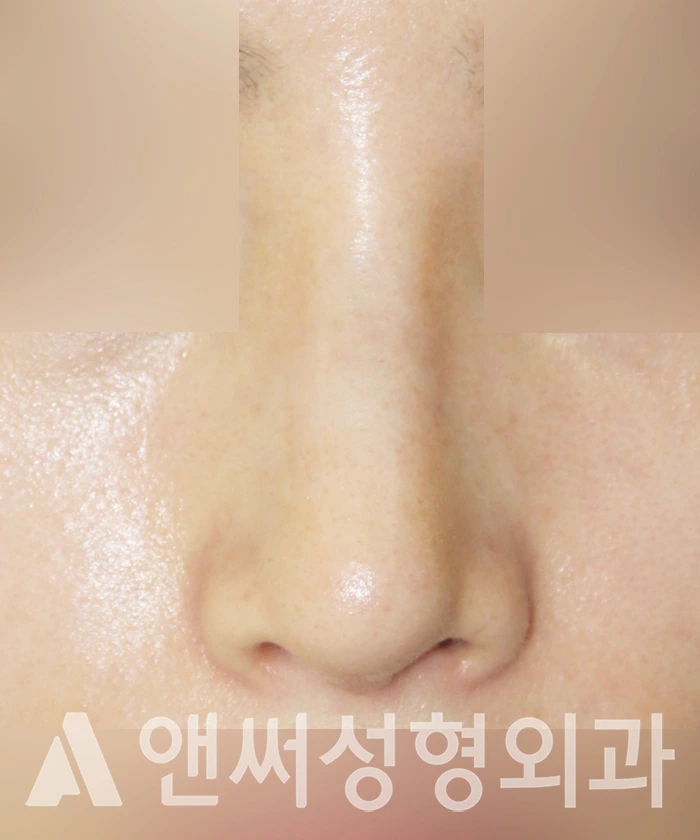Answer Plastic Surgery case 327: After
