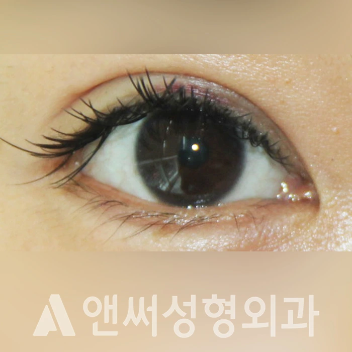 Answer Plastic Surgery case 325: After