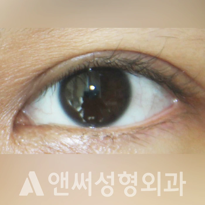 Answer Plastic Surgery case 324: After