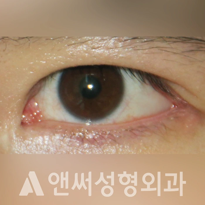 Answer Plastic Surgery case 323: After