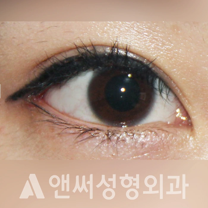 Answer Plastic Surgery case 321: After