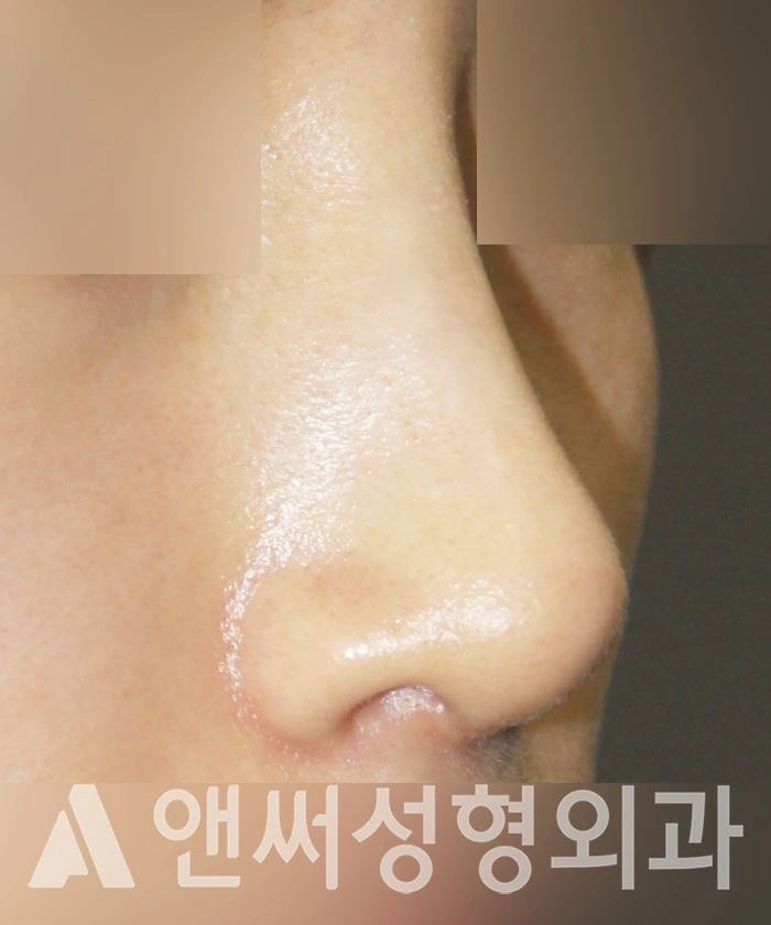 Answer Plastic Surgery case 320: After