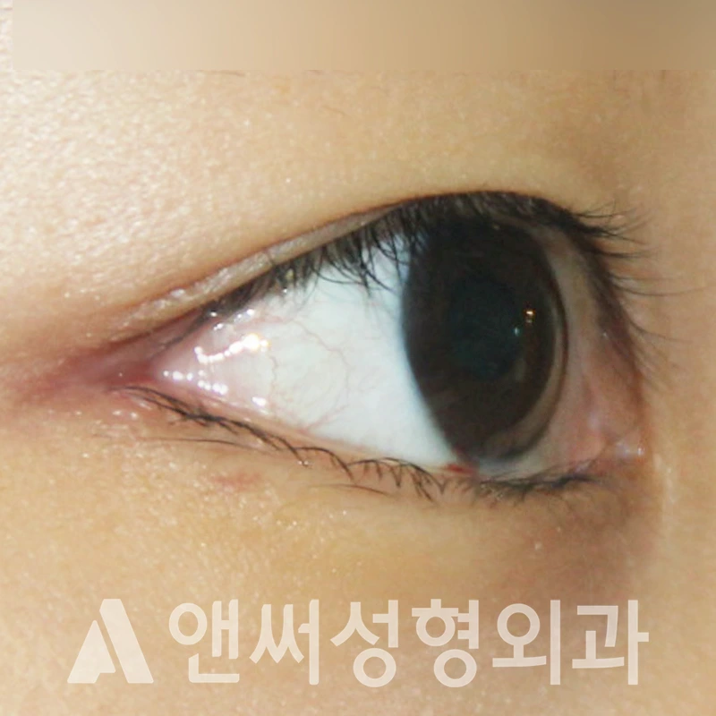 Answer Plastic Surgery case 317: After
