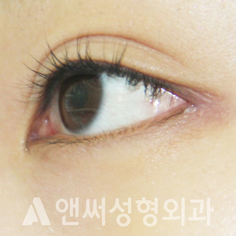 Answer Plastic Surgery case 313: After