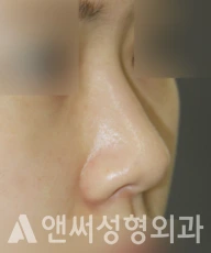 Answer Plastic Surgery case 288: Before