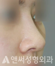Answer Plastic Surgery case 288: After