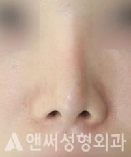Answer Plastic Surgery case 287: Before