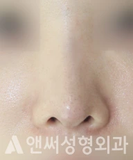 Answer Plastic Surgery case 287: After