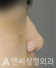 Answer Plastic Surgery case 286: Before
