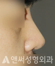 Answer Plastic Surgery case 286: After