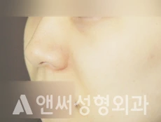 Answer Plastic Surgery case 285: Before