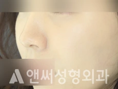 Answer Plastic Surgery case 285: After