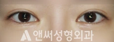 Answer Plastic Surgery case 284: Before