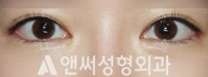 Answer Plastic Surgery case 284: After