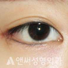 Answer Plastic Surgery case 283: After